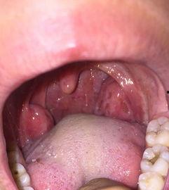 吃白瓜喉咙肿,揭秘饮食安全与应急处理  第2张